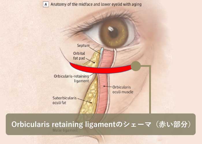当院の下眼瞼の治療について